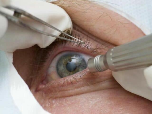 Exames oftalmológicos. (Foto: Prefeitura de Três Barras SC/Divulgação)