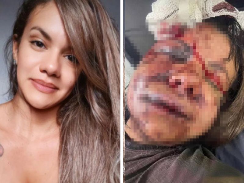 Imagens mostram antes e depois da mulher